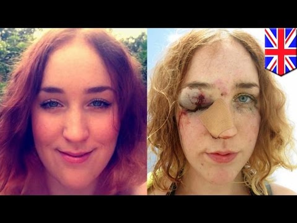 Woman punched in face: Leeds University student Mary Brandon assaulted at Notting Hill Carnival