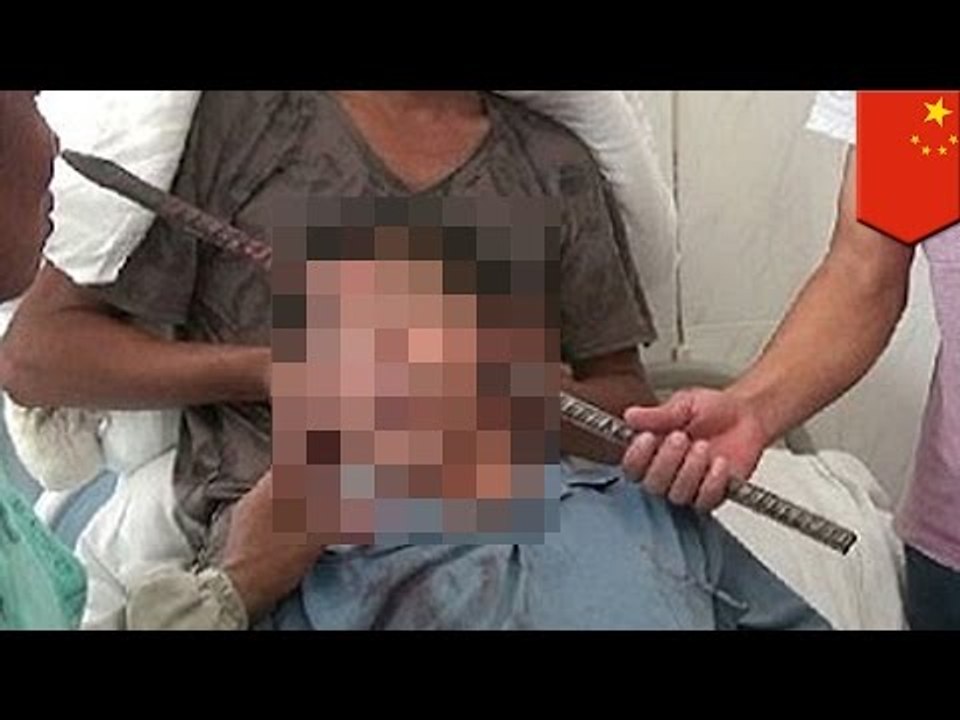 Graphic accident: Chinese man gets speared through his skull