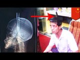 Knife in head: Chinese man catches knife in head while walking down street in Guangyuan