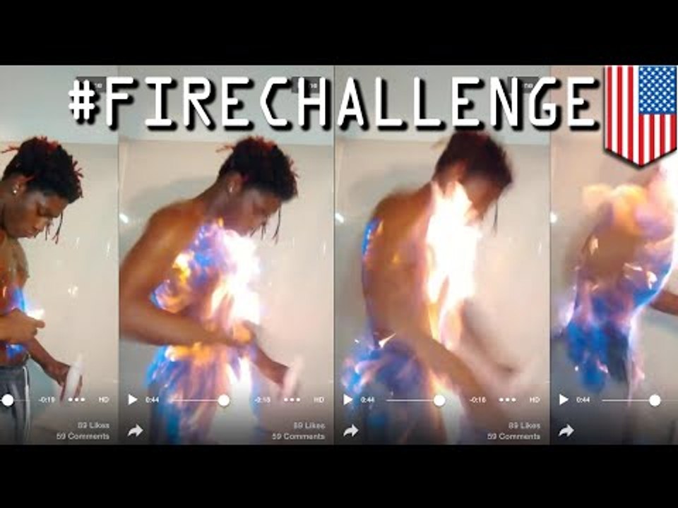 Stupid internet trends: #firechallenge sends idiots to the burn wards