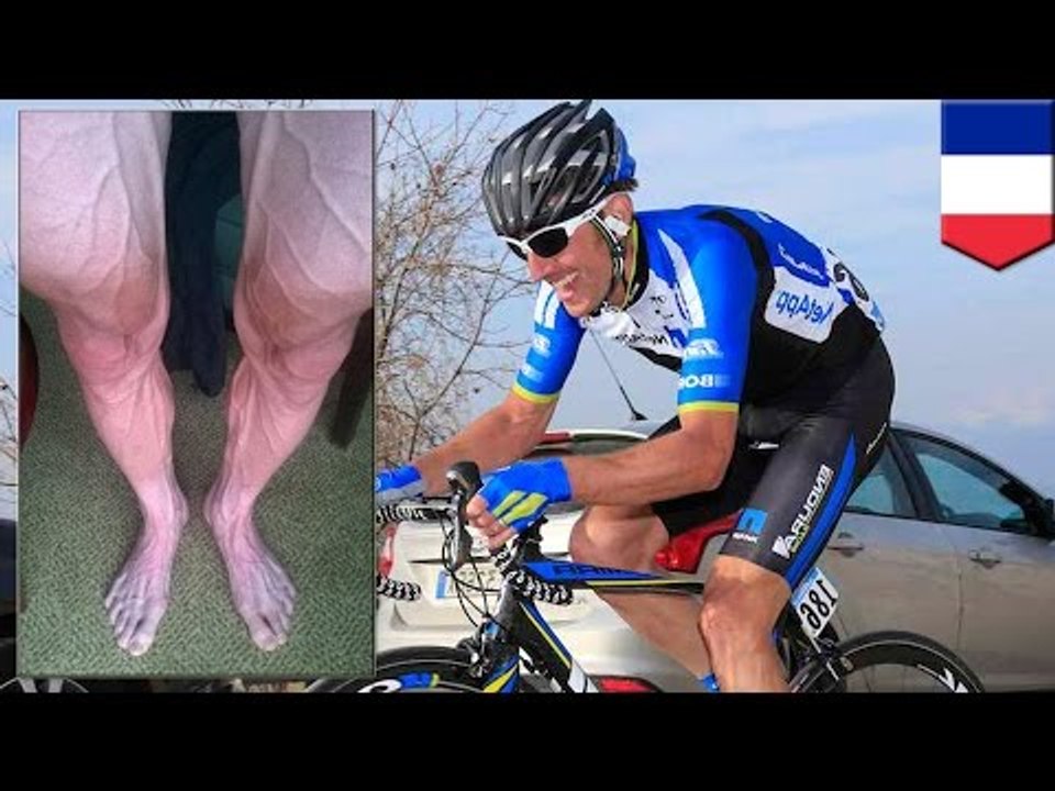 Bartosz Huzarski’s veiny legs photo on Facebook stirs doping allegations