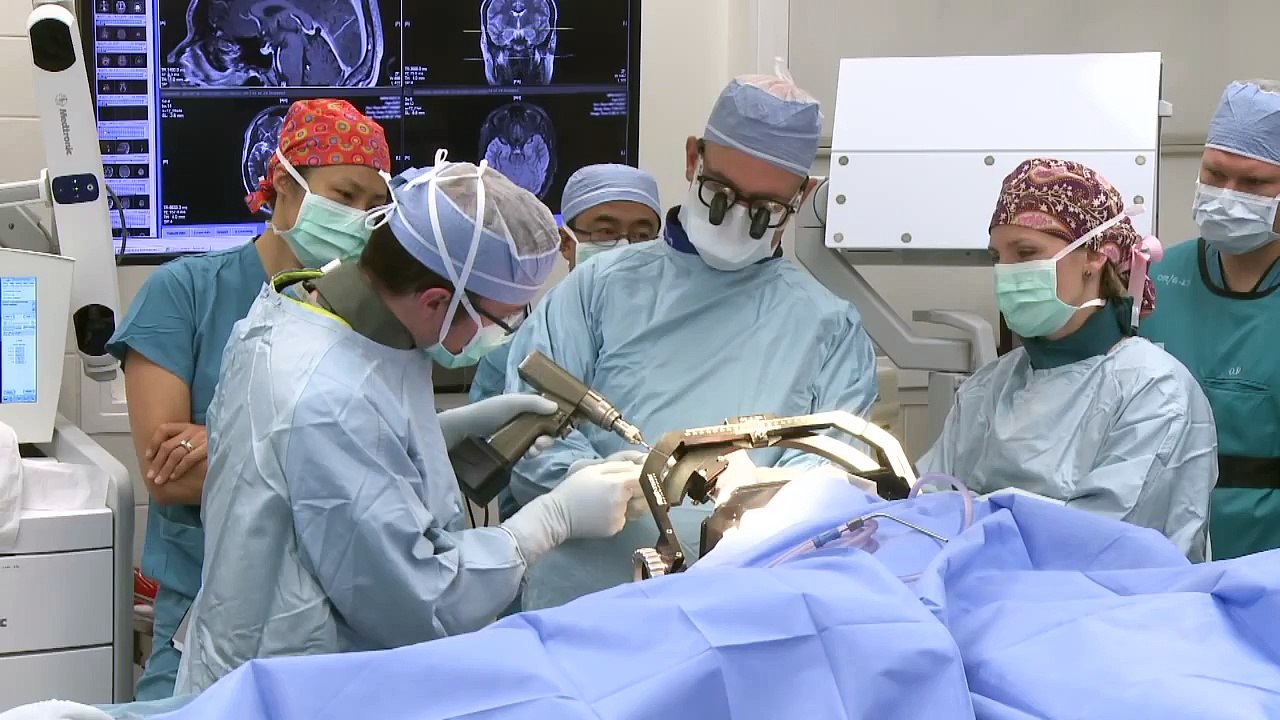 What Happens During a Laser Ablation Surgery for Epilepsy?