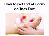 How to Get Rid of Corns on Toes Fast
