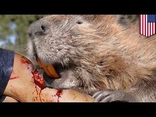 Mad beaver mauls Rochester man in Irondequoit River