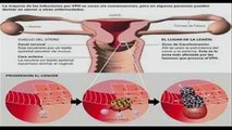 Cancer Cervical en Mujeres Latinas
