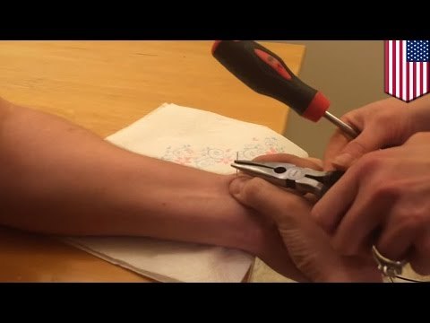 Mężczyzna wyciska pryszcza przy użyciu igły i śrubokręta