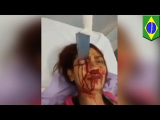 Cud: Kobieta dźgnięta nożem w czoło przeżyła.