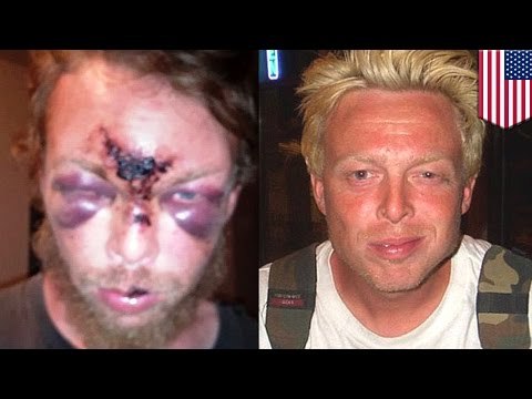 Brutalność policji: mężczyzna zmasakrowany przez policjanta.