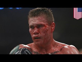 Zawodnik UFC Joe Riggs postrzelił się w nogę.