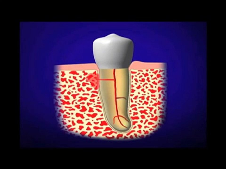 Dr. Cliff Ruddle: Introduction to Root Canal Treatment