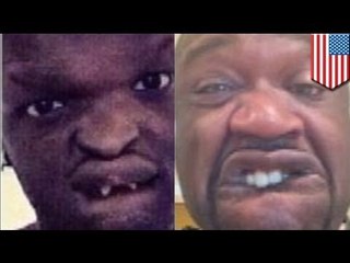 Shaq selfie: O'Neal under fire for mocking disabled fan Jahmel Binion's selfie on Instagram