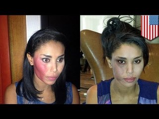 Napastnik sam zgłosił się na policję po pobiciu kobiety.