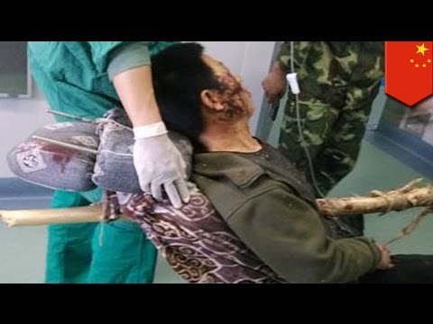 Graphic highway accident: shocking photos show Chinese driver impaled by giant wooden stake