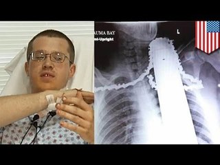 Tree trimmer defies death after chainsaw blade gets lodged in his neck