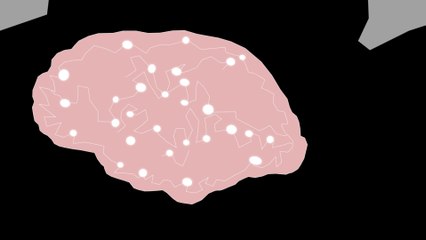 Space Radiation And The Brain