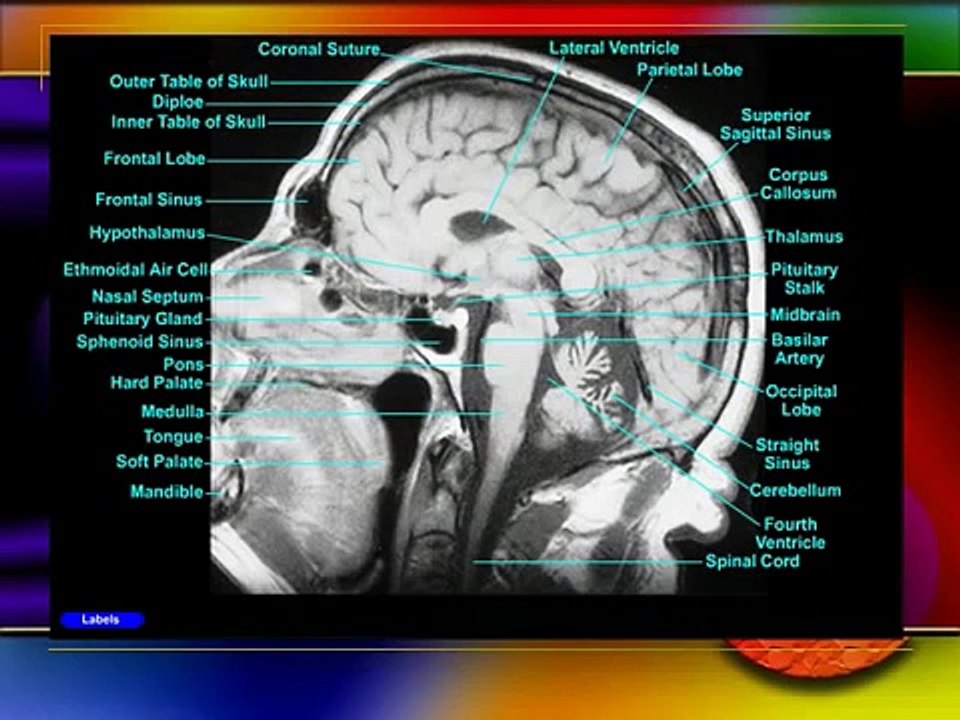 Brain MRI Interpretation