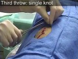 Suturing a Wound | Suturing Techniques