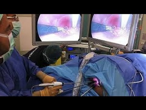 Una combinación de dos fármacos logra reducir el cáncer de colon en el 67% de los casos