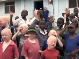 Under The Same Sun: Working to stop the murders of Tanzanians with Albinism