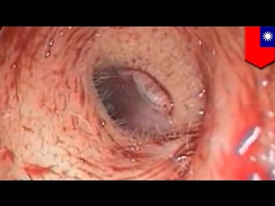 SHOCKING VIDEO: Maggot found in Taiwanese woman...
