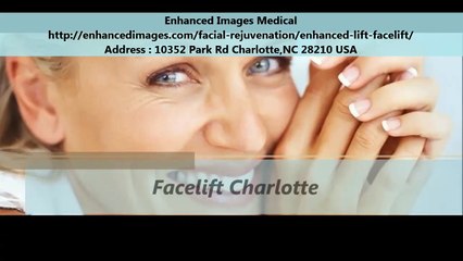 Enhanced Images Medical Facelift Charlotte North Carolina