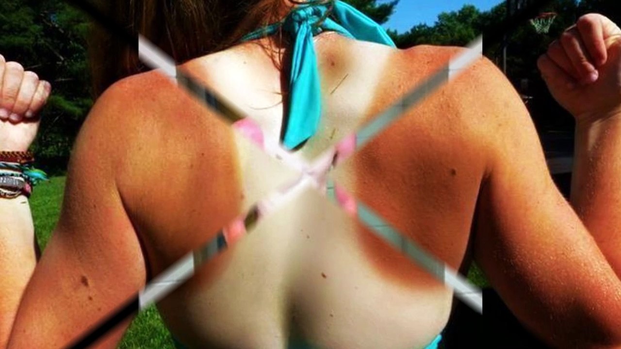 Top 10 des pires marques de bronzage