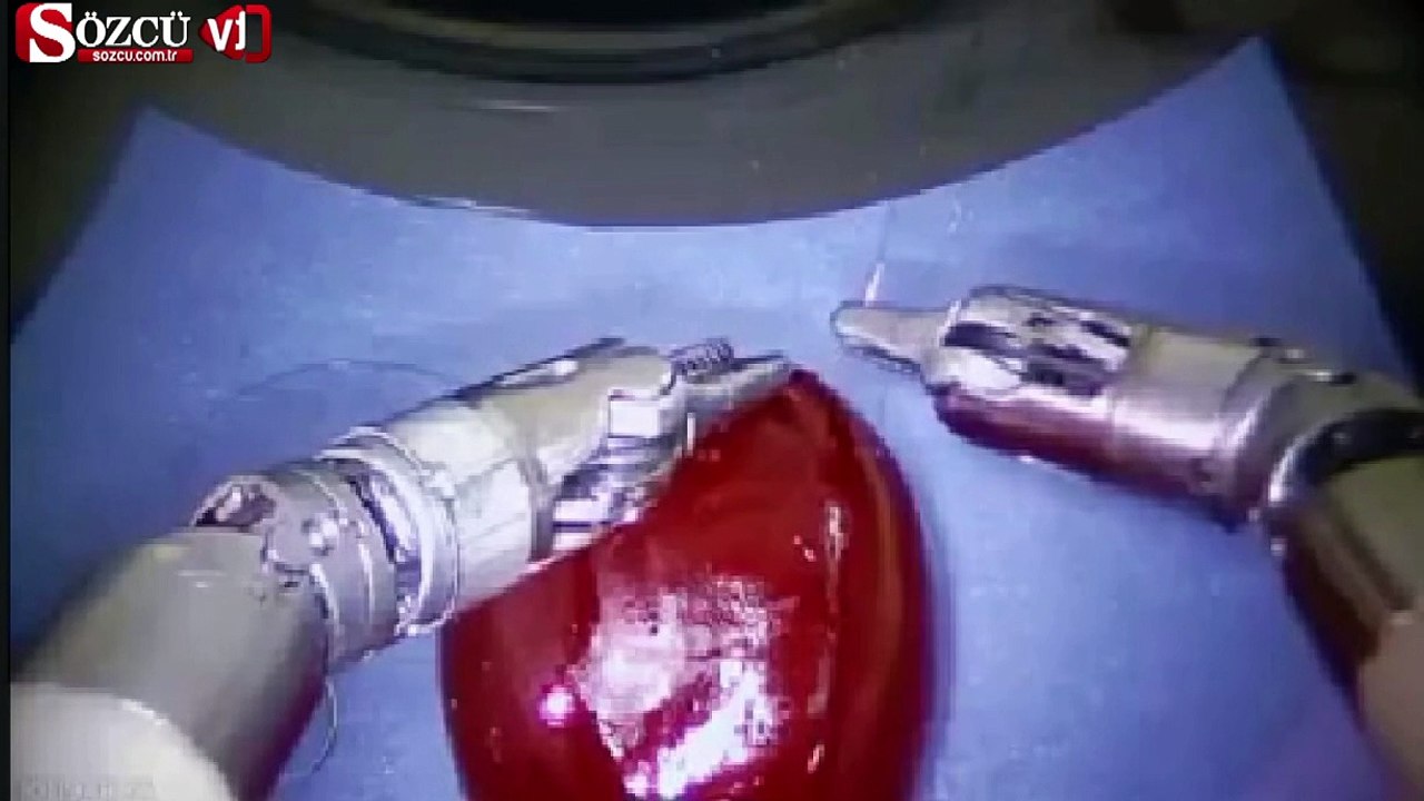 Yaraya dikiş atan robot!