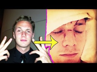 Paris Hilton's brother beaten up by Lindsay Lohan's friend in Miami