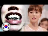 South Korean woman miraculously recovers her decayed teeth through reality show