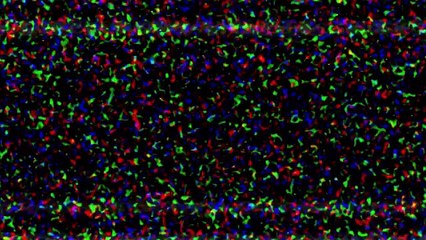 Welcome to Me Official Trailer #1 (2015) - Kristen Wiig, James Marsden Movie HD