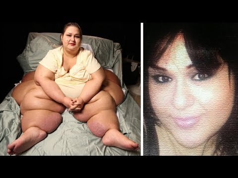 Half ton killer: Transformed after losing 600 pounds