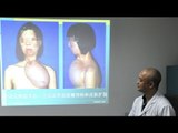 Chinese burn victim gets face transplant using tissue from her chest
