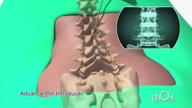 Medical Animation / Ghost Productions / Spineology