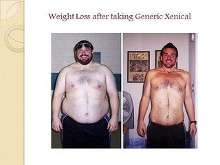 Generic Xenical - Best Weight Loss Pills
