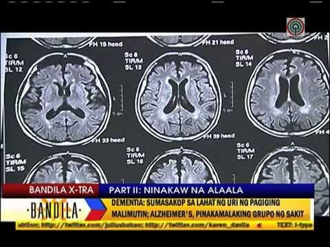 How Alzheimer's patients cope with condition?