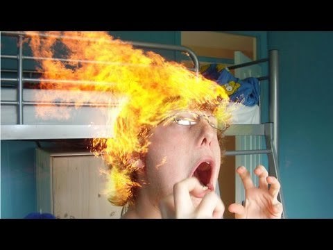 Fire dancing accident at South African surfing party