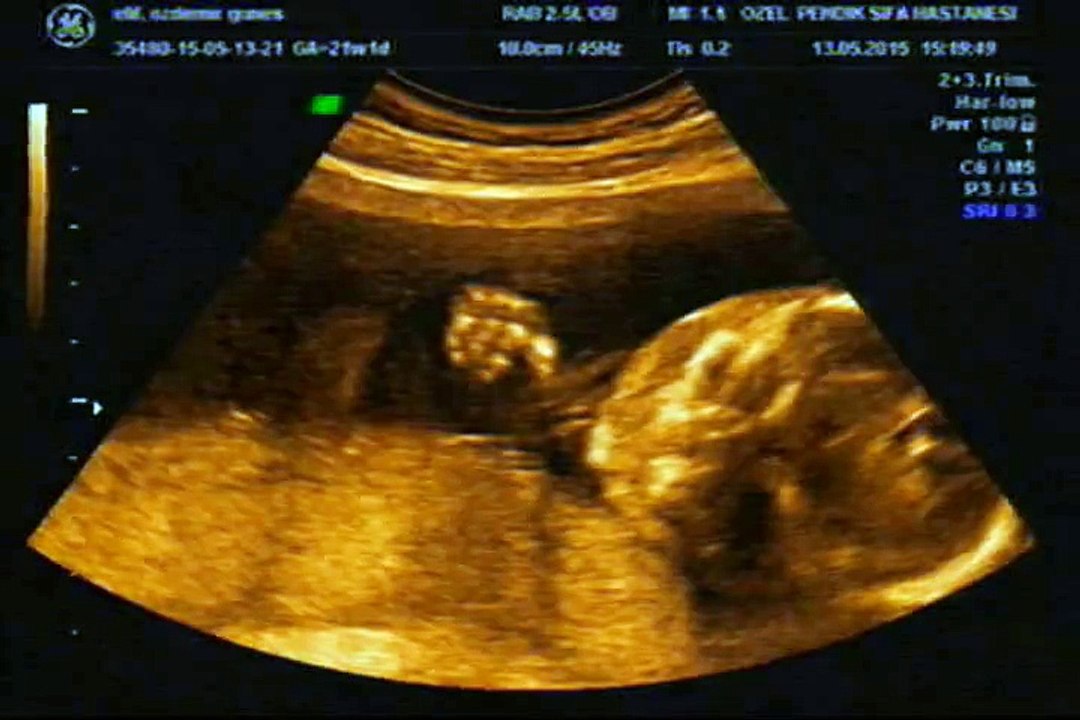 Geçici olarak ekledim izleyin sileyim . :)