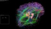 Artificial Brain Simulation - Thalamocortical System, 3.5 Billion Synapses, 16.7 Million Neurons