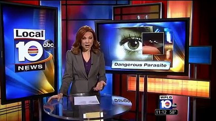 Parasite Grows In 18-Year-Old Girl's Dirty Contact Lens & Eats Through Her Eyeball!
