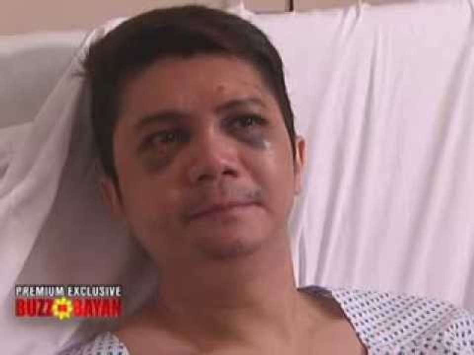 WATCH Uncut : Vhong Navarro, first and exclusive interview after The Fort attack