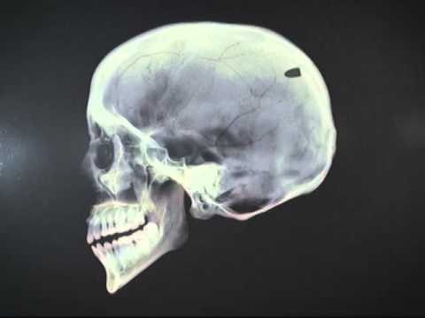 GOT TO BELIEVE : Ang Pagbabago ni Joaquin!