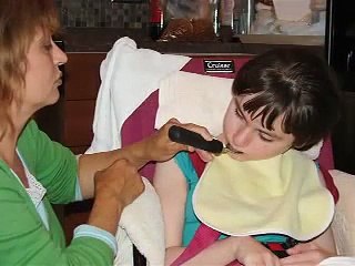 Alexis Basile CDKL5, Atypical Rett Syndrome