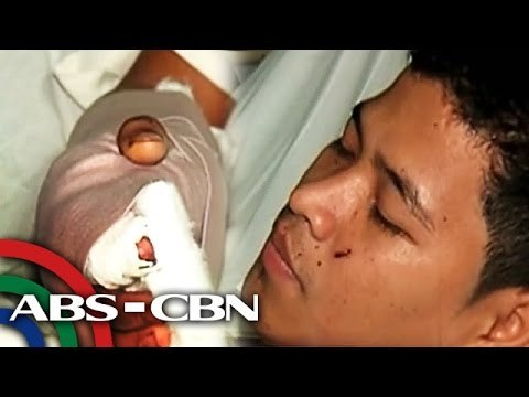 Lalaki gumaya sa kapitbahay, nadisgrasya sa paputok