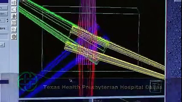 Infinity Linear Accelerator Enhances Cancer Treatment at Texas Health Presbyterian Hospital Dallas