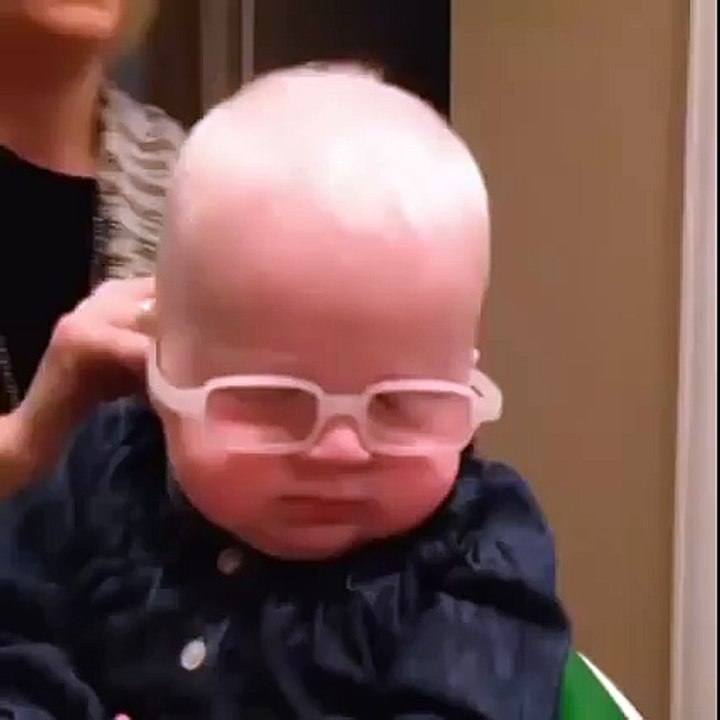 Annesini İlk Defa Gören 7 Aylık Albino Hastası Bebek