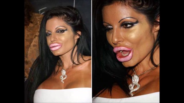 Biggest esthetic surgery fails - crazy compilation