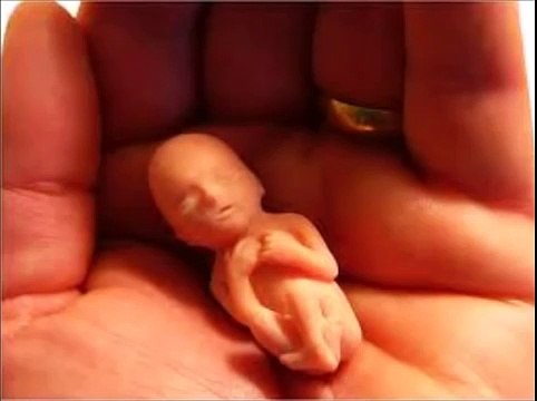 10 weeks pregnant, 10 weeks pregnant symptoms, 10 weeks pregnant pictures