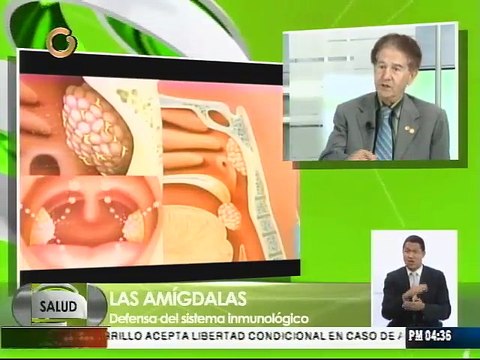 Función de las amígdalas: prevenir infecciones