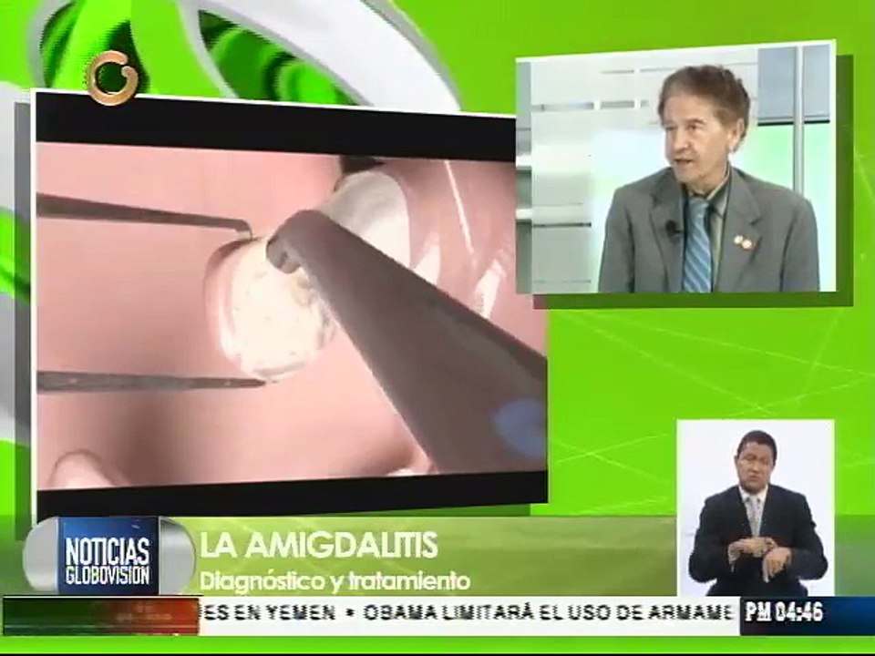 Recomendaciones para prevenir la amigdalitis