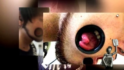 Could This Be The Most Extreme Piercing Ever?